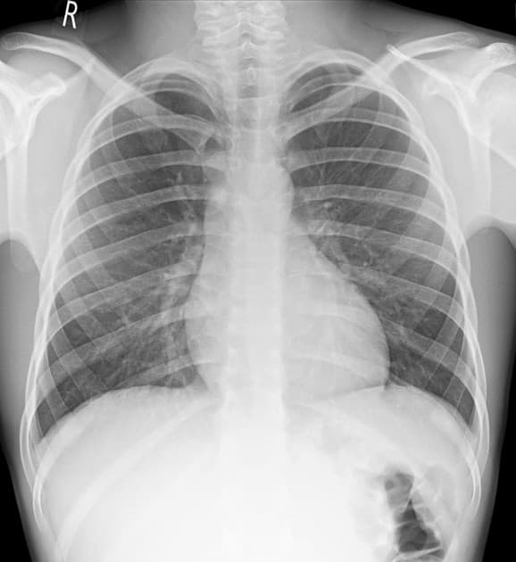 Fairness en imagerie médicale